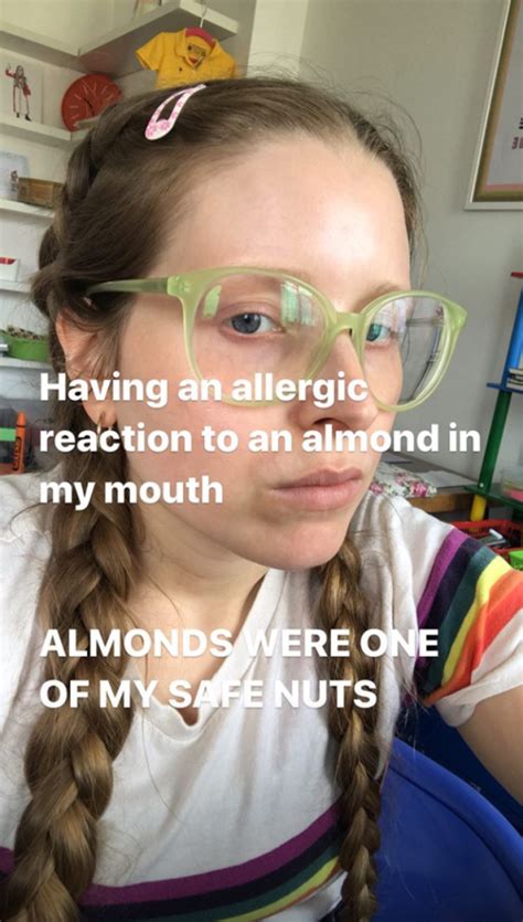 Pregnant Harry Potter Star Jessie Cave Has Allergic Reaction After