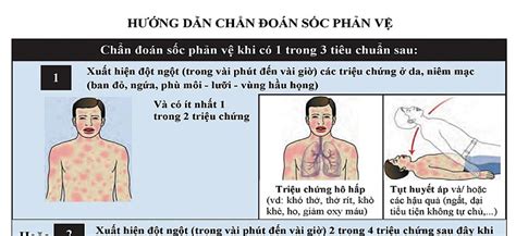 Phác đồ Chẩn đoán Chống Sốc Phản Vệ Mới Nhất Của Bộ Y Tế