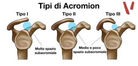 Acromion Anatomia E Funzioni Project Invictus