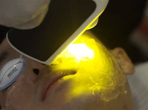 Pro Yellow Laser In Singapore A Comprehensive Guide