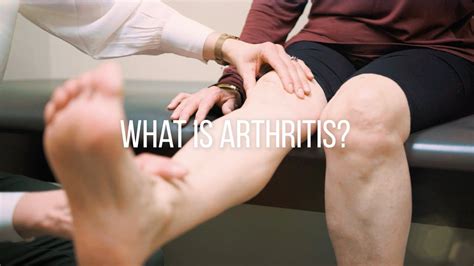 Knee Arthritis Causes Symptoms And Treatment Youtube