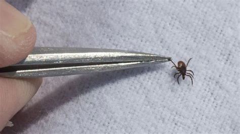 How To Remove Ticks The Right Way