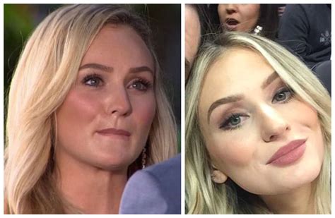 Did Lauren Bushnell Get Plastic Surgery Experts Weigh In On Before And