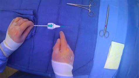 Using The Angio Seal Vascular Closure Device Youtube