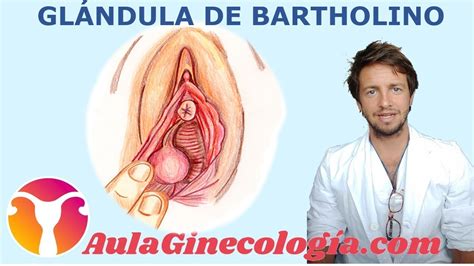 Gl Ndula De Bartholino Quiste Bartholinitis Y Absceso Tratamiento Ginecolog A Y