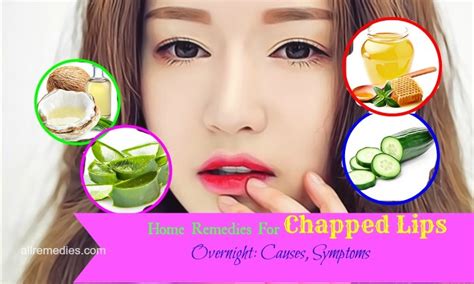 Top 15 Home Remedies For Chapped Lips Overnight Causes Symptoms