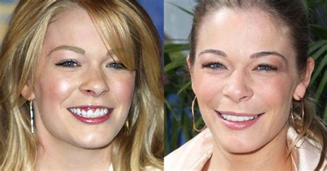 Hilary duff teeth has dental veneers. Celebrity Teeth: Before And After | Teeth Matter!!! | Pinterest | Teeth, Dental and Celebrity