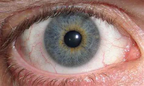 Blue Ring Around Eye Is It Normal Or Dangerous