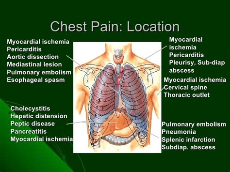 Differential Diagnosis Of Chest Pain By Dr Farooq On 29 02 30 H
