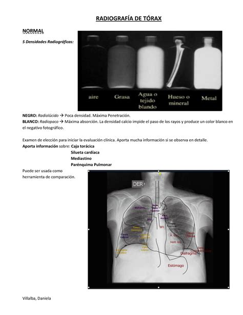 Radiograf A De T Rax Vocabulario Descripci N Y Patrones Radiograf A De T Rax Normal Studocu