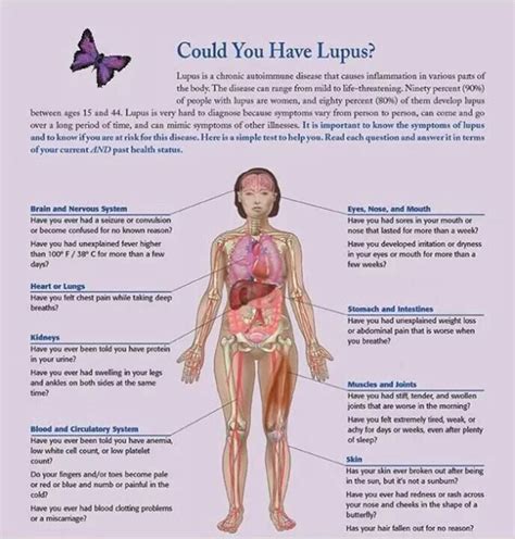 Lupus Chart Lupus Facts Diagnosing Lupus Lupus Awareness