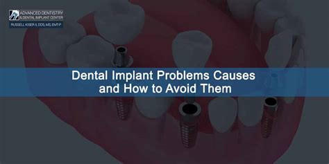 Dental Implant Problems Causes And How To Avoid Them Advanced