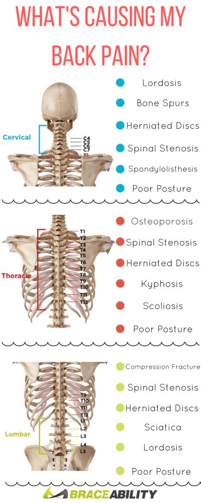 Pain Relief Whats Causing Your Back Pain Learn About The Many Lower
