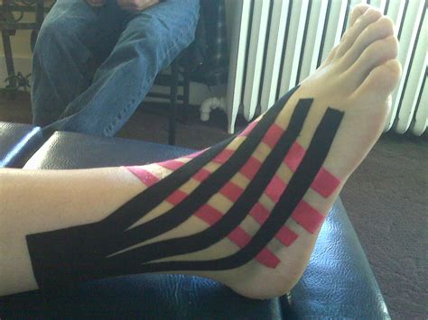 Kinesio Tape Kt For Ankle Sprains Denver Chiropractic Llc
