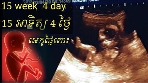 អេកូផ្ទៃពោះ 15 អាទិត្យ 4ថ្ងៃ Pregnancy Ultrasound 15 Week 4day By Dr