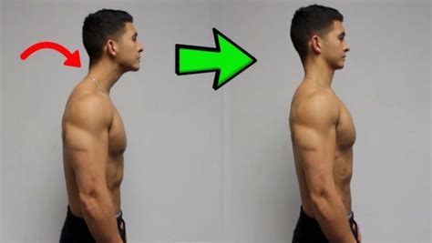 16 Corrective Exercises To Fix Bad Posture