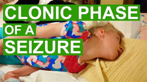What The Clonic Phase Of A Tonic Clonic Seizure Looks Like Sunshine Baby