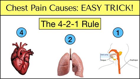 Causes Of Chest Pain Easy Trick To Never Miss An Emergency Must See