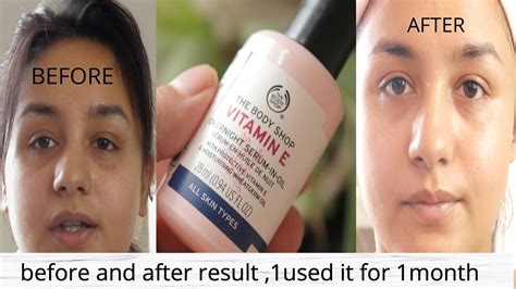 I Applied The Bodyshop Vitamin E Serum For One Month Benefits Review