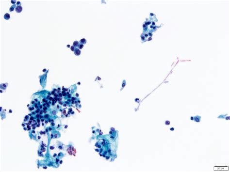 Pathology Outlines Cytology Nonneoplastic