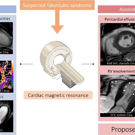 Figure Composition Shows The Combined Role Of Cardiac Magnetic