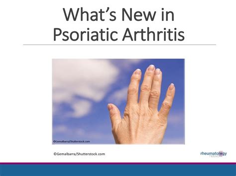 Whats New In Psoriatic Arthritis Rheumatology Network