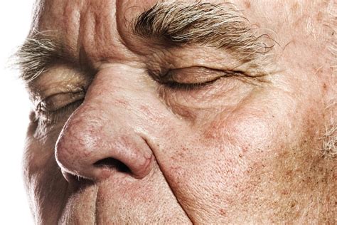For predicting Alzheimer’s, the nose may know