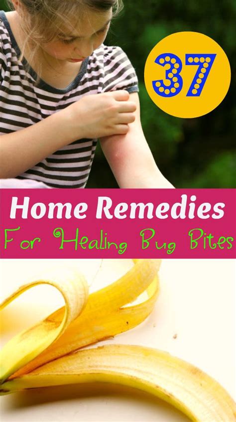 37 Home Remedies For Healing Bug Bites Bug Bites Remedies Home