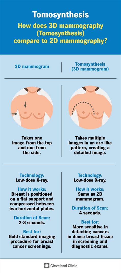 Breast Tomosynthesis