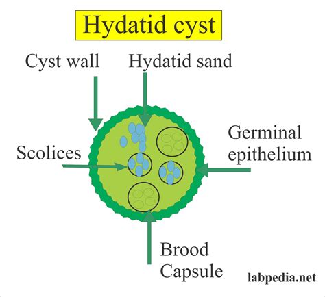 Echinococcus Granulosus Hydatid Disease Hydatid Cyst