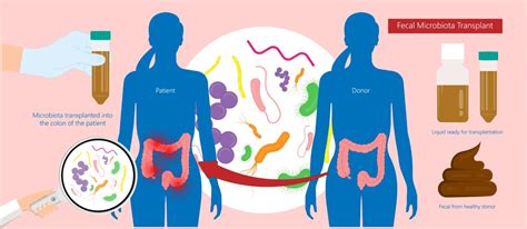 The Gut Microbiome And Its Role In Health And Disease Gideon Global