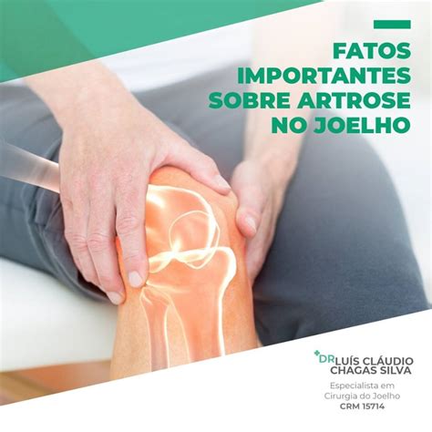 Fatos Importantes Sobre Artrose No Joelho Dr Luis Claudio Chagas