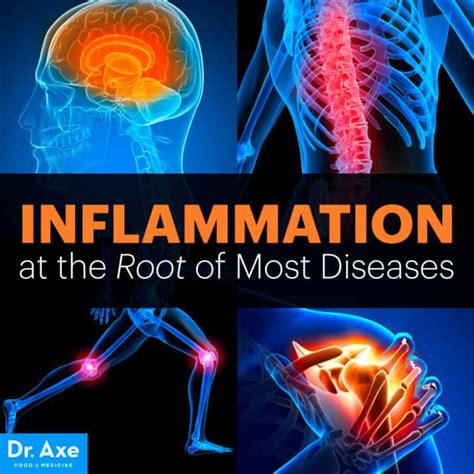 Inflammation At The Root Of Most Diseases