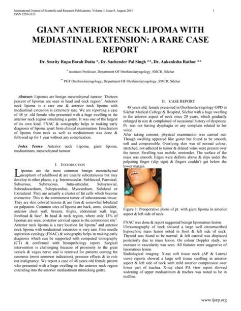 Rare Giant Anterior Neck Lipoma With Mediastinal Extension Ppt