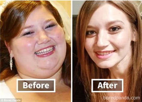 Transformations Show What Weight Loss Does To The Face Pics Lipstick Alley