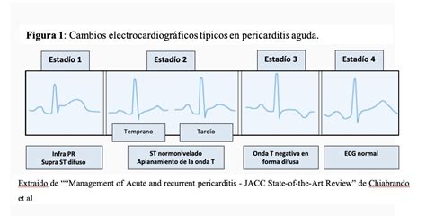 SIAC Manejo De La Pericarditis Aguda Y Recurrente SIAC