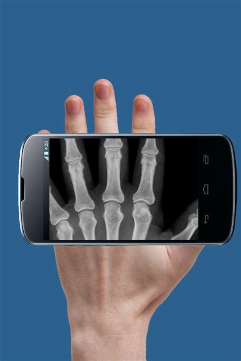 The first one is fake and the second one is real. Real X Ray Body Scanner Prank: X Ray App for Android - APK Download
