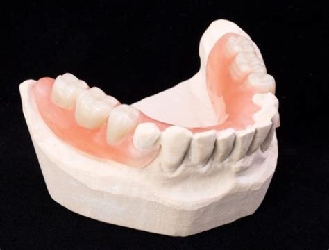Partial Dentures Phoenix Az Missing Teeth Dental Implants