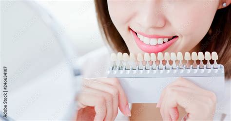 Teeth Whiten Concept фотография Stock Adobe Stock