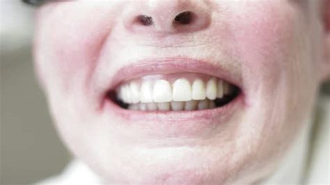 Also, the missing filling can expose dentin, the second layer of tooth under the hard outer enamel. What to Do if Your Filling Fell Out | Angie's List