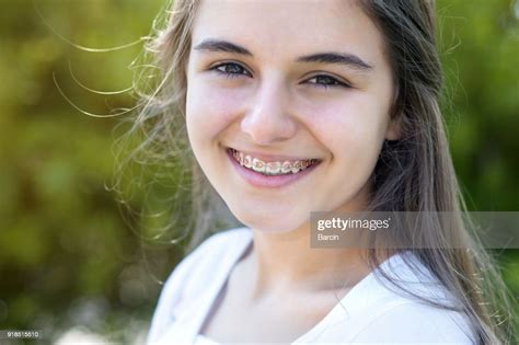 Pretty Teenage Girl Wearing Braces Smiling Cheerfully High Res Stock