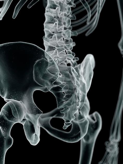 Human Hip Bone Photograph By Sciepro Fine Art America