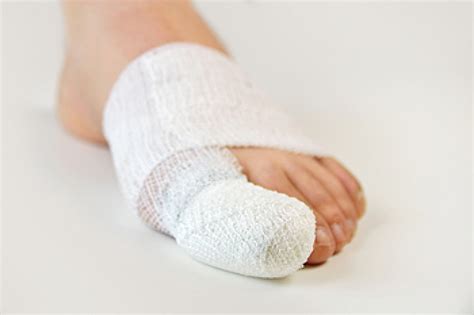 Broken Toe Treatment Options