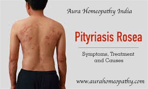 Pin On Best Homeopathy Doctor In India