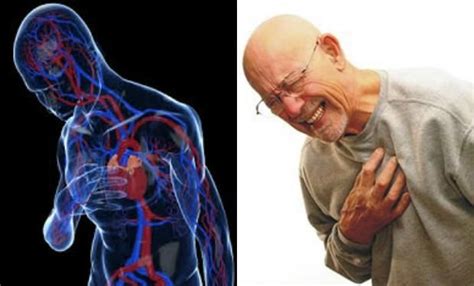 9 sÃntomas para saber si sufres de insuficiencia cardÃaca