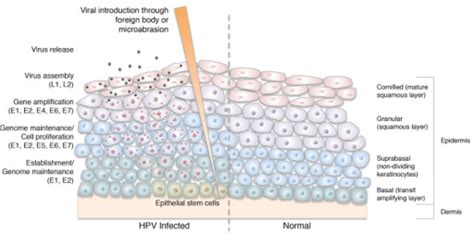 Figure 1 A Schematic View Of The Human Papillomavirus Open I