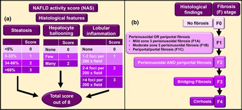 Nafld Activity Score Nas And Staging Of Fibrosis In Nafld A