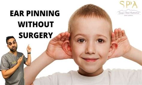 Ear Pinning Without Surgery Sagar Patel Aesthetics Big Ear Fix