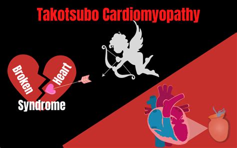 Takotsubo Cardiomyopathy Broken Heart Syndrome Scope