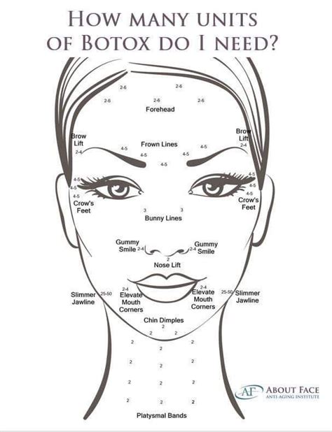 Printable Botox Injection Face Map